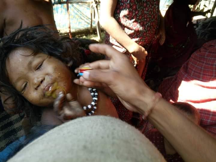 Treatment of Raute Children